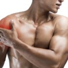 Delayed Onset Muscle Soreness (DOMS)