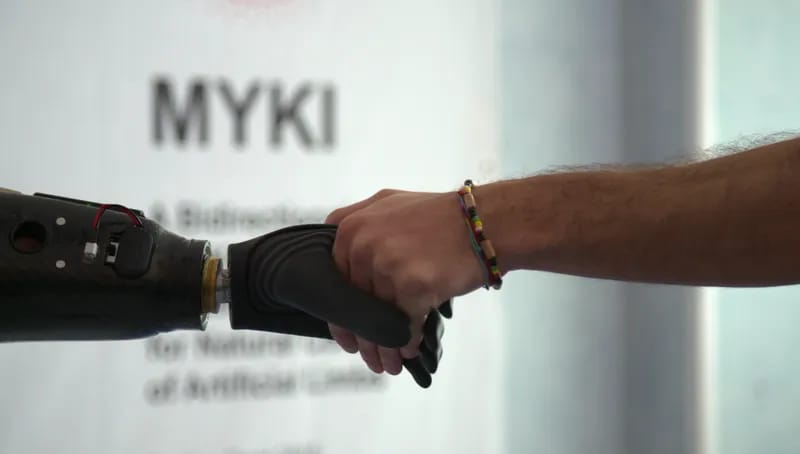 Para peneliti dari Italia berhasil menciptakan terobosan besar dalam teknologi prostetik dengan meluncurkan tangan robotik yang dikendalikan secara magnetis